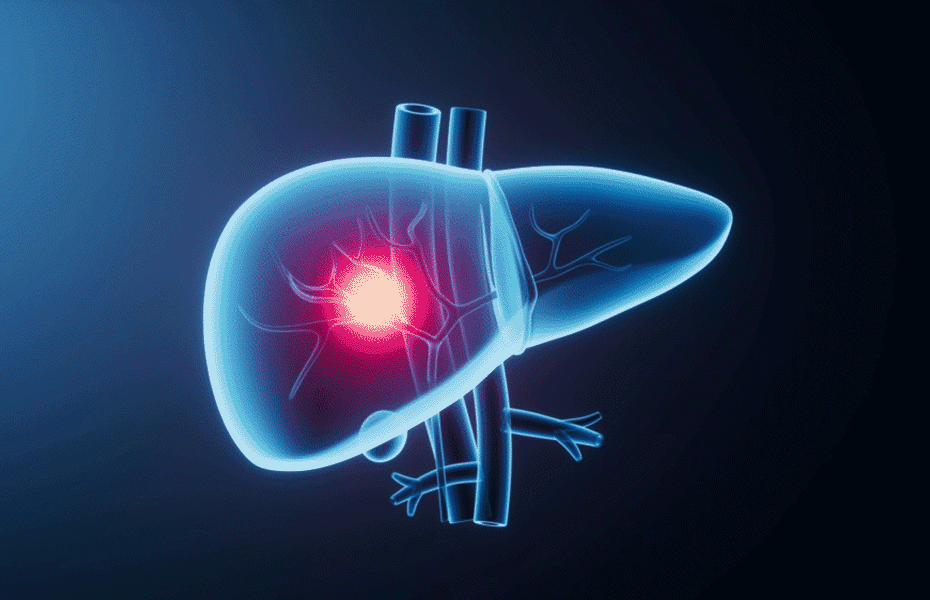 el-informe-liderado-por-china-traza-un-nuevo-curso-para-el-control-global-del-cancer-de-higado